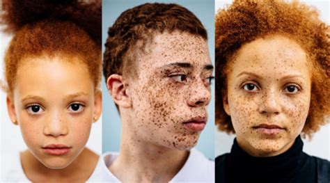 Photographer Documents Beautiful Diversity Of Redheads Of African