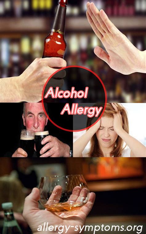 Alcohol Allergy Symptoms And Diagnosis Alcohol Allergy Symptoms