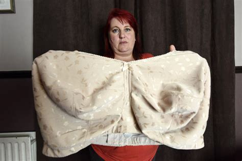Woman Desperate For A Breast Reduction Claims Massive M Chest Nearly