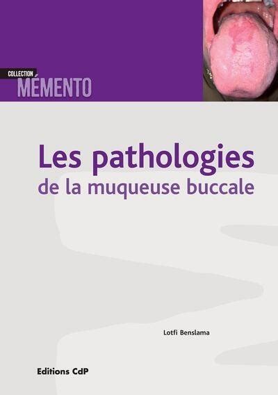 Pathologies De La Muqueuse Buccale Lotfi Benslama 2023 Cdp éditions