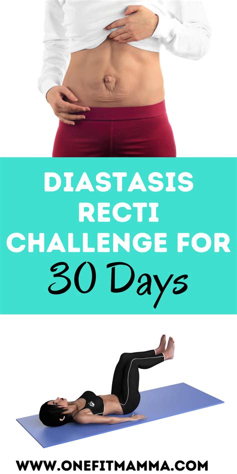 Diastasis Recti Is Really Common In Women After Pregnancy Give This 30
