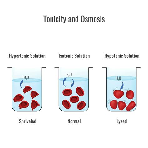 Effects Of Hypertonic Hypotonic And Istonic Solutions To Red Blood