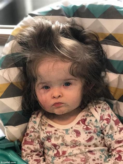 Baby Born With Long Hair