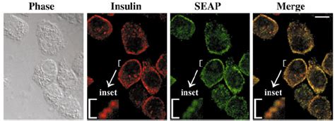 Phase Contrast Microscopy And Confocal Indirect Immunofluorescence Download Scientific Diagram