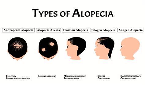 Causes Of Alopecia Dr Batras™