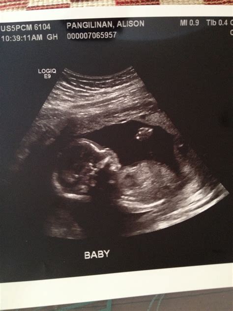Love Baby P 19 Weeks Ultrasound And Gender Reveal