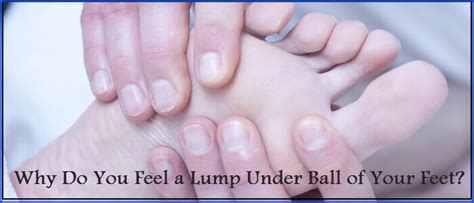 Why Do You Feel A Lump Under Ball Of Your Feet Mortons Neuroma