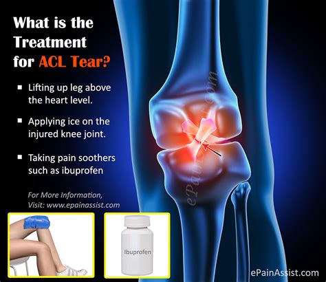 Treatment For Acl Tearsurgerypost Operative Rehabrecovery