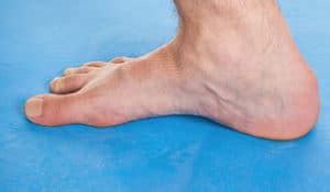 Haglund Deformity Feetfixer
