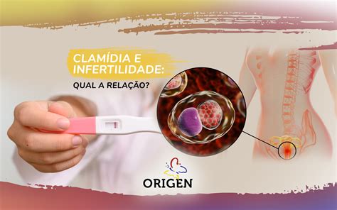 Clamídia e infertilidade qual a relação Clínica Origen Fertilização in Vitro