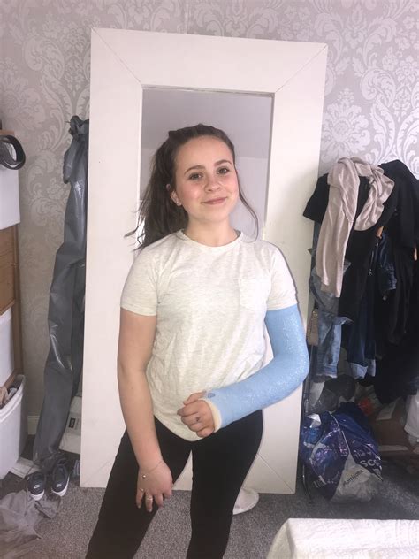Moment Young Scots Gymnast Suffers Horror Arm Break As Loud Snap