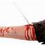 How To Treat A Severe Bleeding Injury  HMB