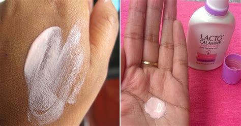 11 Amazing Benefits Of Calamine Lotion How To Use It The Right Way