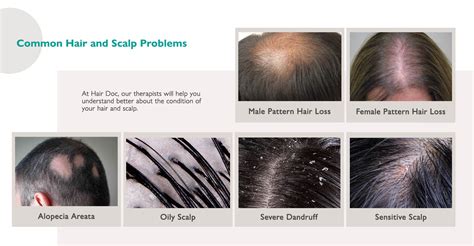 Common Hair And Scalp Problems Examples And Solutions Hair Doc