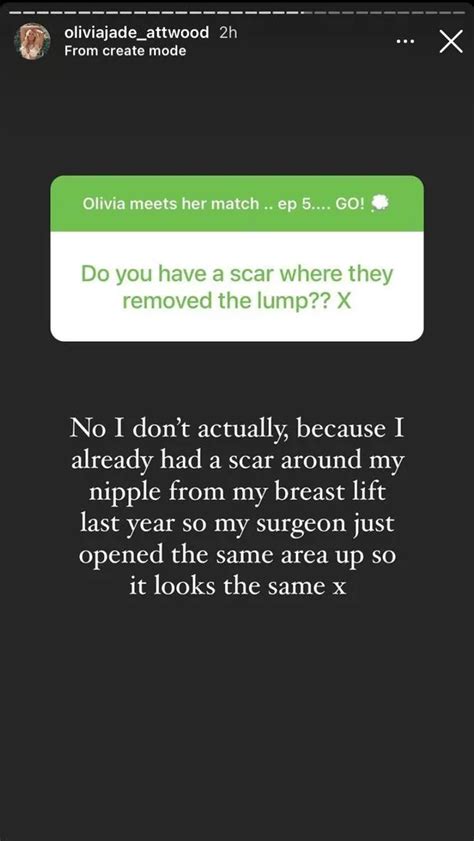 Olivia Attwood Opens Up On Surgery After Breast Cancer Scare And Says