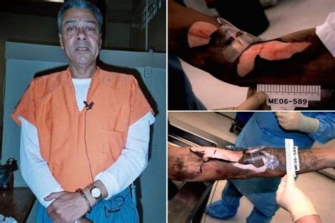 Ted Bundys Brain Was Removed After His Execution For Gruesome