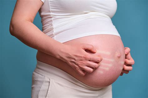 Cholestasis Of Pregnancy Itching While Pregnant And Other Symptoms