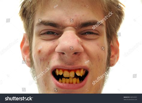 Ugly Man Showing Off Crooked Yellow Stock Photo 40254331 Shutterstock