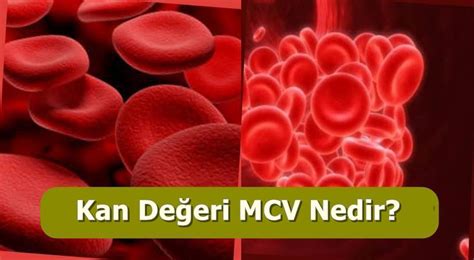 Kan Değeri MCV Nedir? Ne Demektir? MCV Düşüklüğü