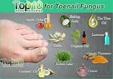 Home Remedies For Fungus Between Toes Pictures