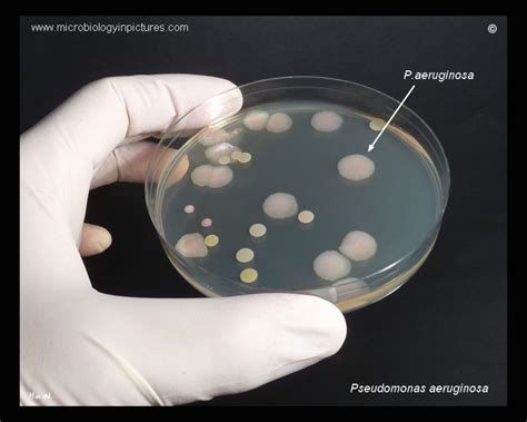 Pseudomonas Aeruginosa And Staphylococcus Aureus Golden Staph On Tsa