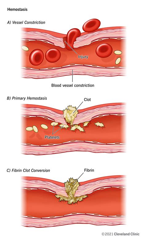 Hemostasis Stages And How The Process Stops Blood Flow