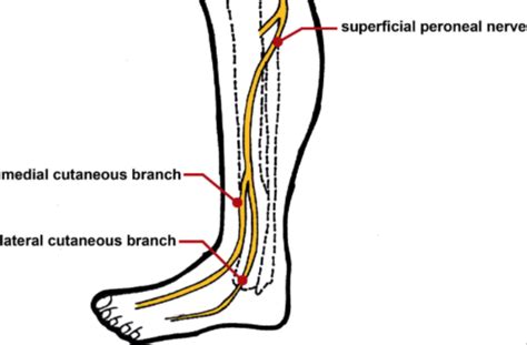 Superficial Peroneal Nerve Injury In A Professional Runner A Case