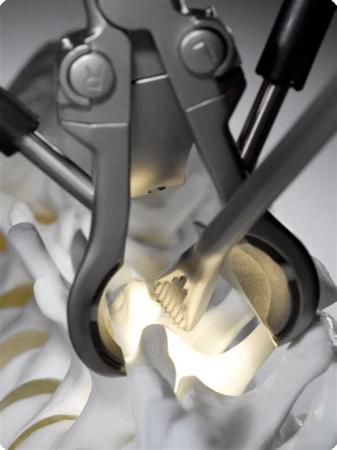 First Access System Designed Specifically For Minimally Invasive