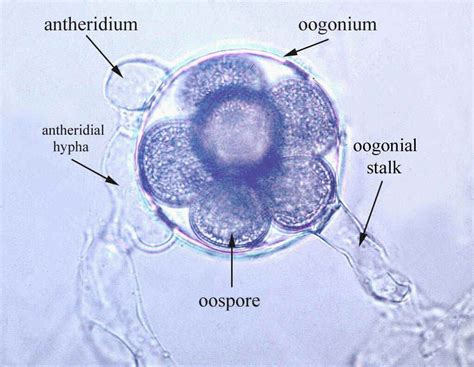 Oomycetes Plant Pathology Labels Microbiology