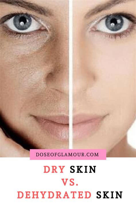 Dry Vs Dehydrated Skin Dehydrated Skin Is A Skin Condition That Lacks