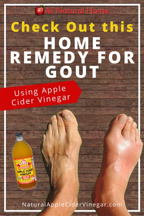 The Best Home Remedy For Gout Apple Cider Vinegar All Natural Home