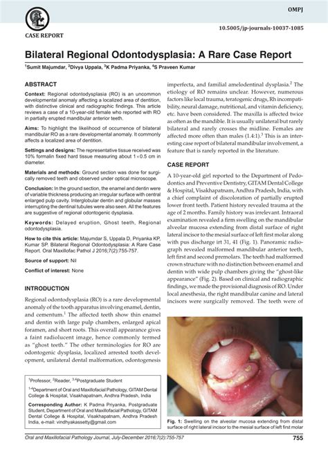 Pdf Bilateral Regional Odontodysplasia A Rare Case Report