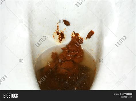 Toilet Bowl Brown Image And Photo Free Trial Bigstock