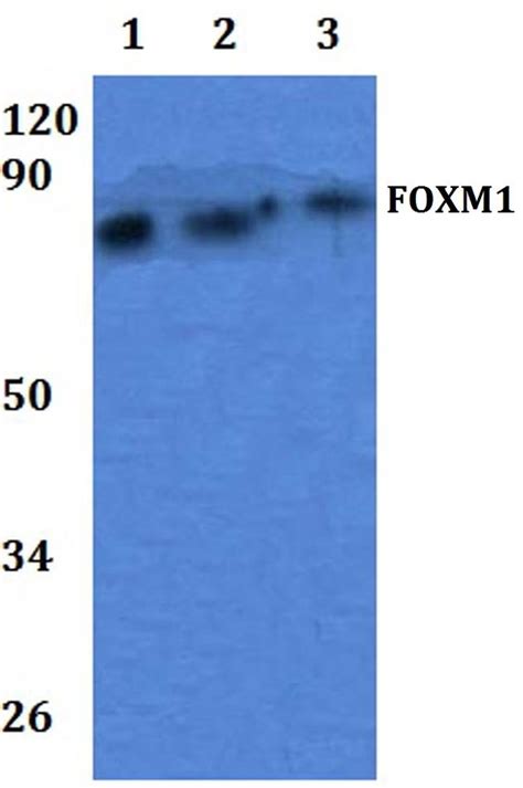 Foxm1 Polyclonal Antibody Pa5 86894