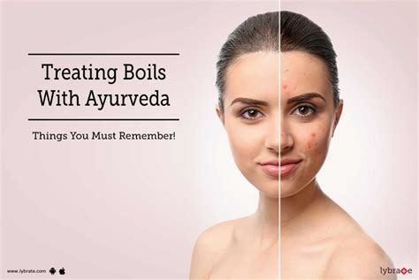Treating Boils With Ayurveda Things You Must Remember By Dr