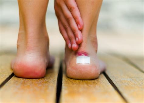 Have A Blister On Your Foot Heres How To Treat It Foot And Ankle Group
