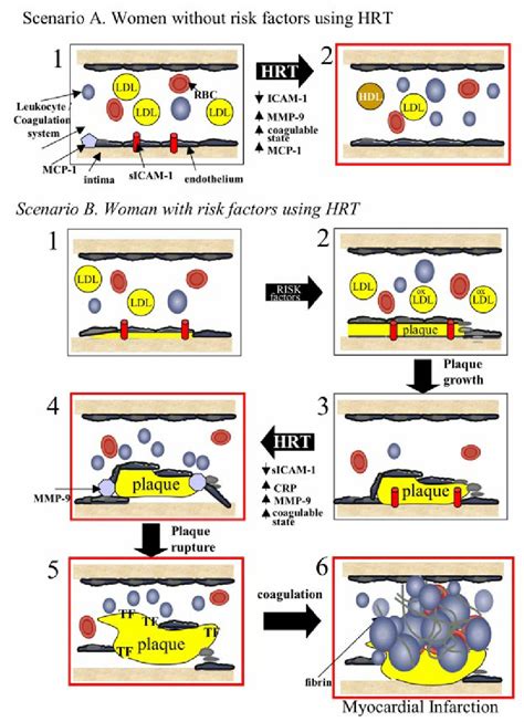Role Of Hormone Replacement Therapy Hrt In Atherogenesis In Women Download Scientific Diagram