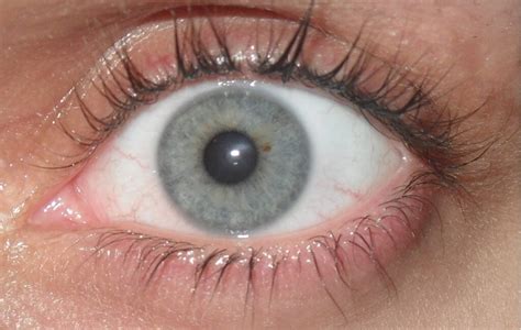 Gray Eyes Pictures Genetics And Facts