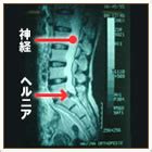 福岡市南区「南島整形外科」-腰部脊柱管狭窄症、腰椎椎間板 ...