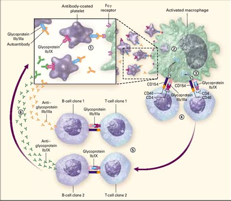 Idiopathic Thrombocytopenic Purpura Diagram