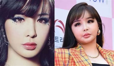 Park Bom Plastic Surgery Before And After Pics Age