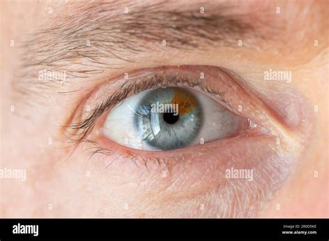 Macro Of A Man Eye With Heterochromia Extreme Close Up Of Human Eye Of