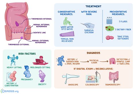 Thrombosed Hemorrhoid What Is It Causes Diagnosis Treatment And