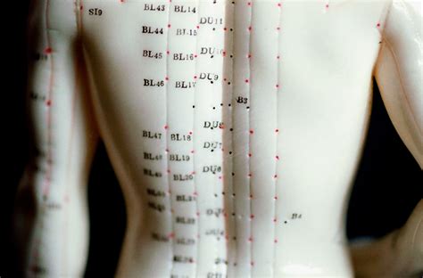 How Does Acupuncture Work? - Acupuncture Brisbane Woolloongabba