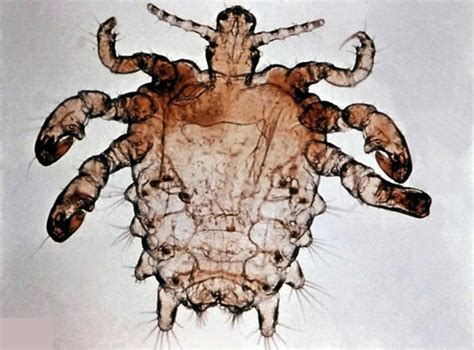 Pubic Lice Or Crab Lice Signs Symptoms Transmission And Pubic Lice Treatment