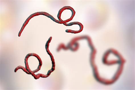 Ebola Virus Disease Evd Symptoms And Causes