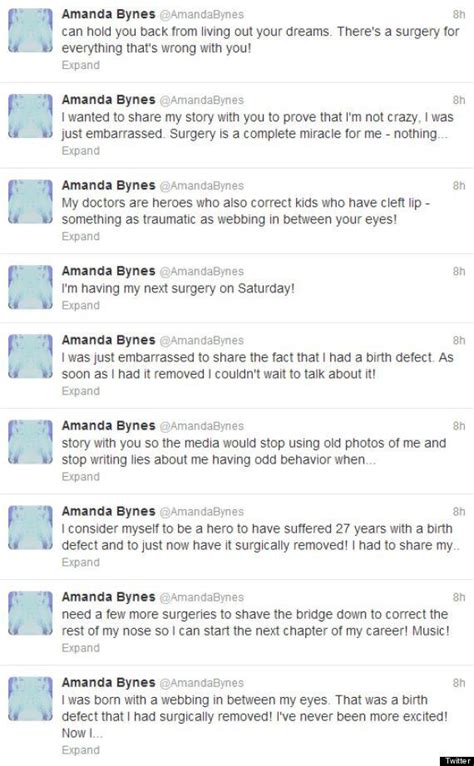 amanda bynes reveals further surgery in bizarre twitter rant huffpost uk entertainment