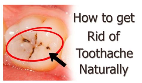 How To Get Rid Of Toothache At Night Home Remedies How