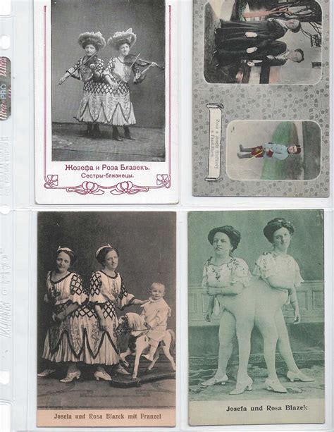 Josefa And Rosa Blazek Four Post Cards Conjoined Twins Very Good Post Card Toadlily Books