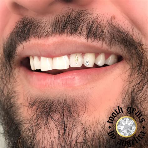 14k gold plated single top tooth grill cap custom grillz canine teeth hip hop. 24k gold lightning bolt tooth gem with a Swarovski crystal#toothgem #toothgems #smile #longbeach ...